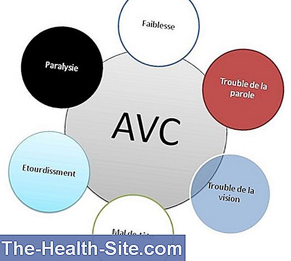 Avc Symptômes Et Signes Avant Coureurs Scientifique Et Pratique