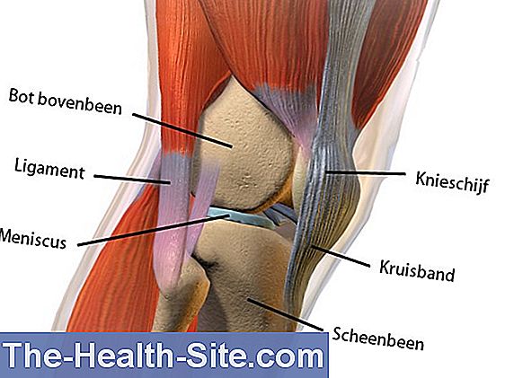 Gescheurd ligament op de knie