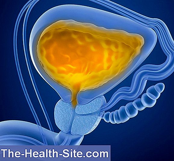 Cancer De La Vessie Sympt Mes Causes Et Traitement Scientifique Et Pratique Medical Journal