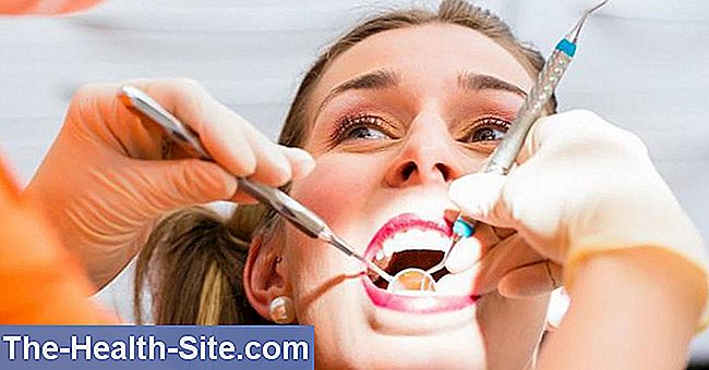 Professionell tänder rengöring - kostnader