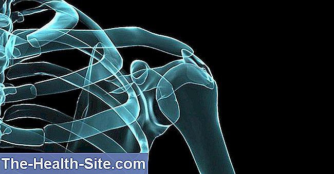 restricționarea mișcării în articulația umărului după rănire exacerbarea artrozei genunchiului