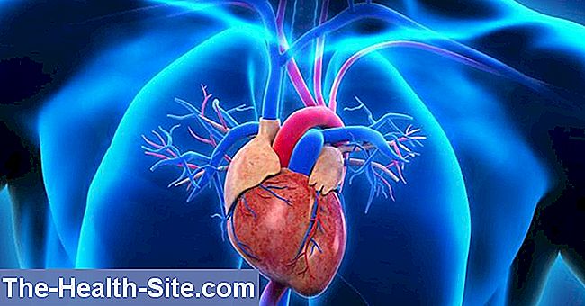 Cardiomiopatie dilatativă