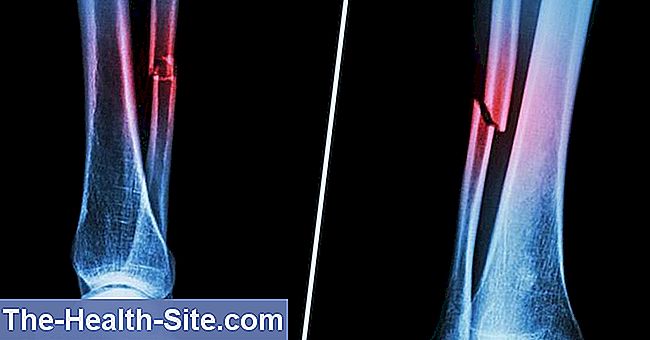 durerea articulară provoacă genunchiul nu există lichid în genunchi
