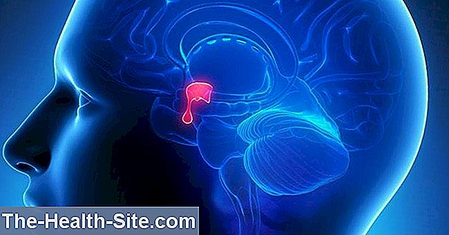 Tumorile glandei pituitare – cancerul hipofizar