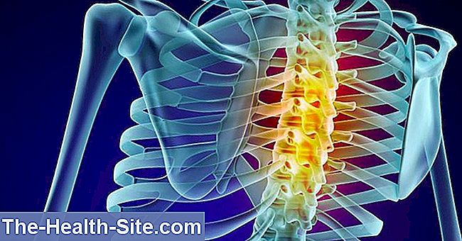 inflamația articulațiilor coloanei vertebrale cervicale nutriție pentru durerile articulare