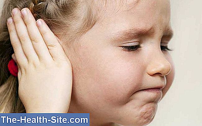 Ūminis vidurinės ausies uždegimas (otitis media acuta)