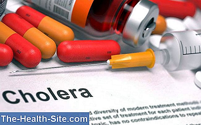 Cholera (tulžies pūslės viduriavimas)