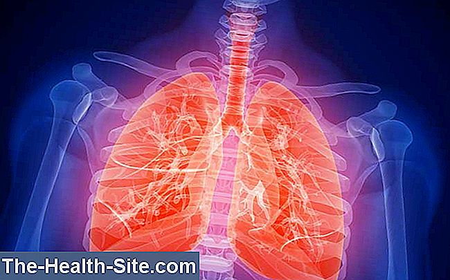 Cor pulmonale (plaušu sirds)
