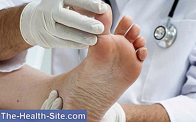 cornuri între tratamentul degetelor de la picioare program detoxifiere turcia