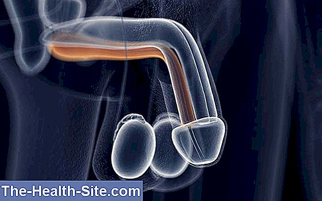 tratamentul conservator al curburii penisului erecția strică ablația