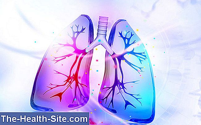 Plaučių embolija