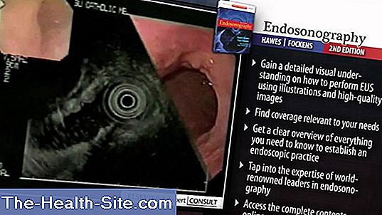 Endosonography Ultrasound From The Inside 💊 Scientific Practical