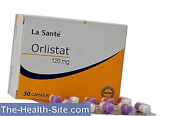 Se puede tomar orlistat en el embarazo