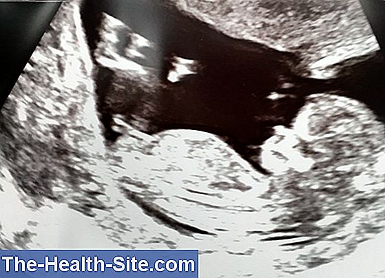 Gravid: pige eller dreng?