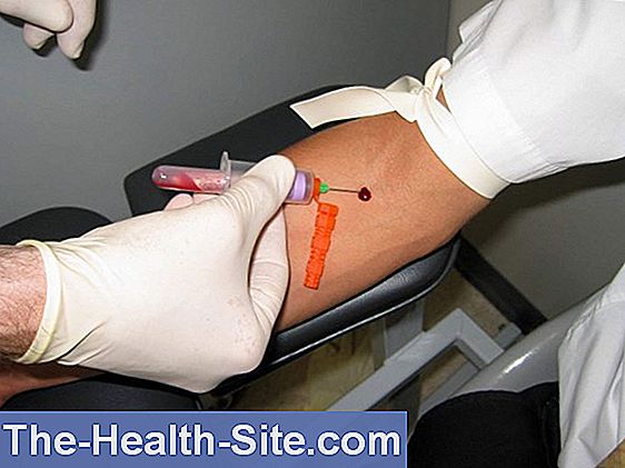 what-does-high-ggt-and-hematocrit-mean-in-blood-test