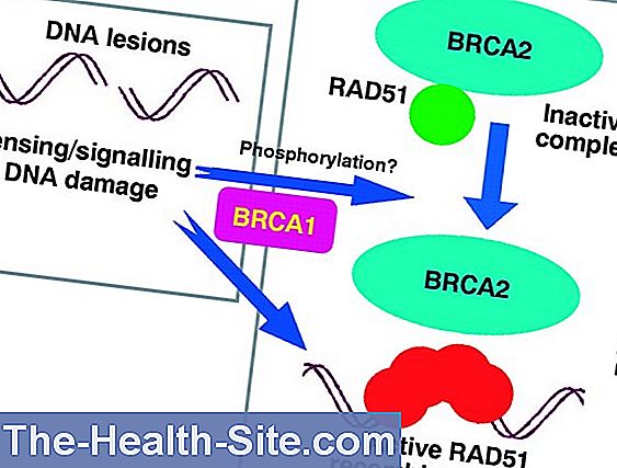 Breast cancer genes brca1 and brca2