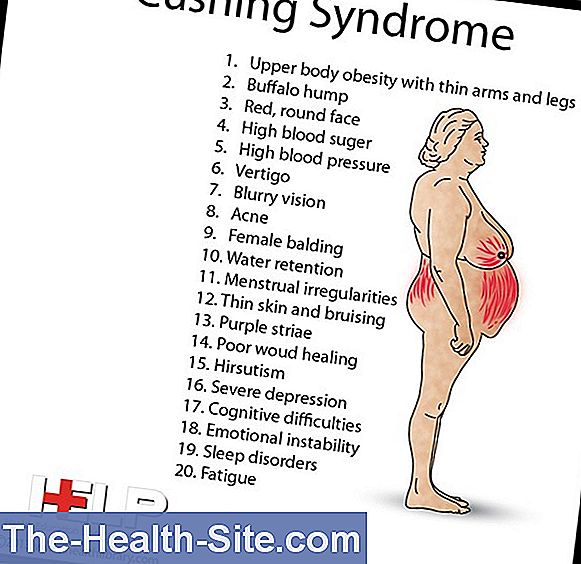 Cushing'S Disease Causes, Symptoms, Therapy 💊 ScientificPractical