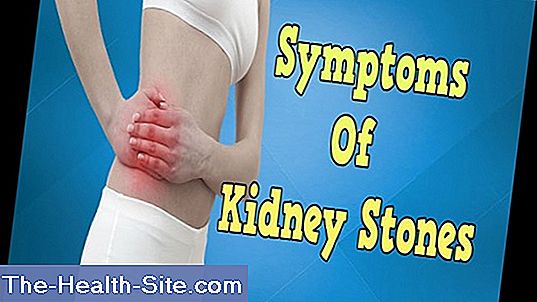 Kidney stones - symptoms