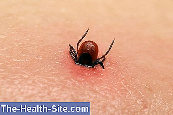 Tick ​​bite - what to do?