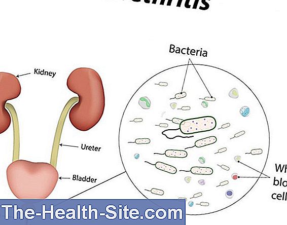 Urethritis Causes Symptoms Treatment 💊 Scientific Practical Medical