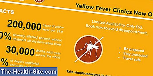 Yellow Fever: Causes, Symptoms, Diagnosis, Treatment 💊 Scientific ...