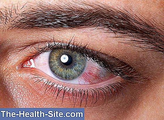 Office eye syndrome - so prevent it