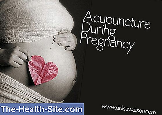 Acupuncture in pregnancy