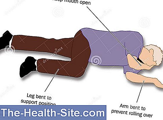 Лотераль. Lateral position. Lateral coital position. Lateral stability. Positions for first Aid.