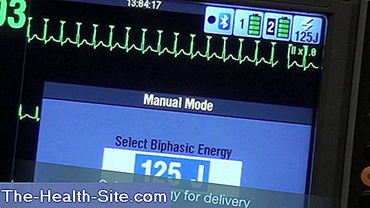 cardioversion-reasons-procedure-and-risks-scientific-practical