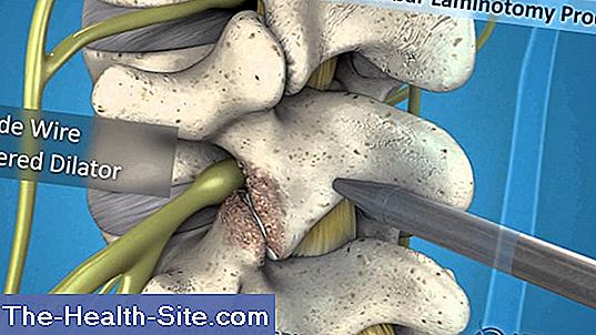 Laminectomy Definition Process And Risks 💊 Scientific Practical Medical Journal 2023 