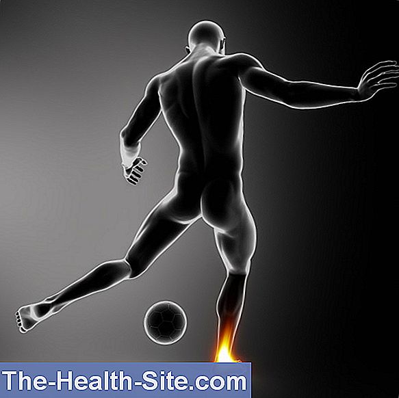 Lesiones deportivas - dislocación