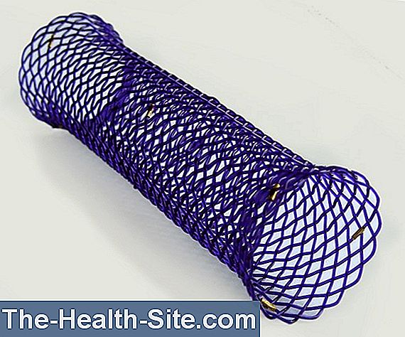 Stent Definición, Razones, El Procedimiento Y Los Riesgos 💊 Científico