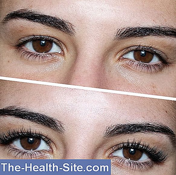 Sensation De Corps Étranger Dans Les Yeux Causes, Premiers Secours 💊 — free download