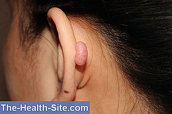 Ear infiammazione