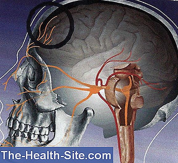 Nevralgia Del Trigemino Sintomi Cause Terapia 💊 Scientifico Pratico 7835