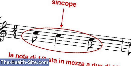 Sincope