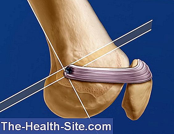 luxația obișnuită a tratamentului articulației genunchiului