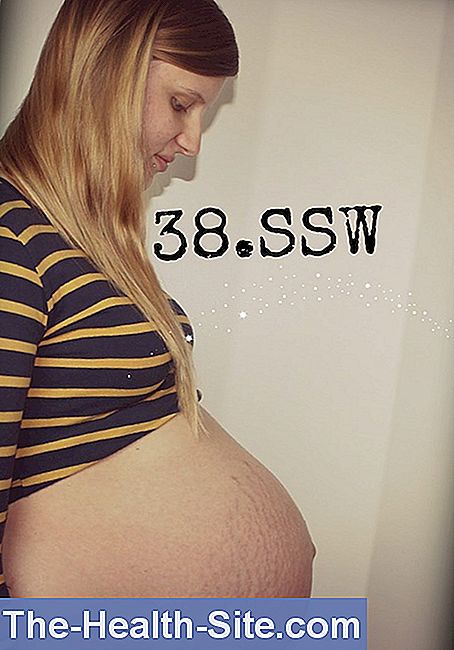Ssw 38