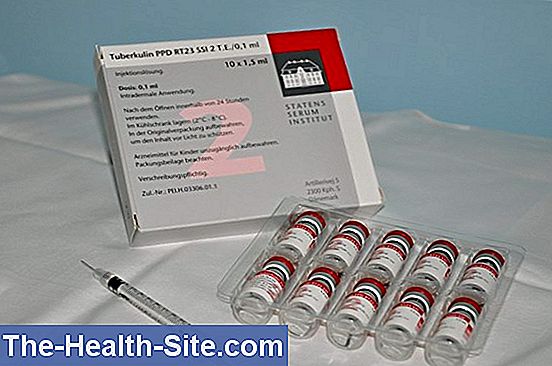 Tuberkuloze tests