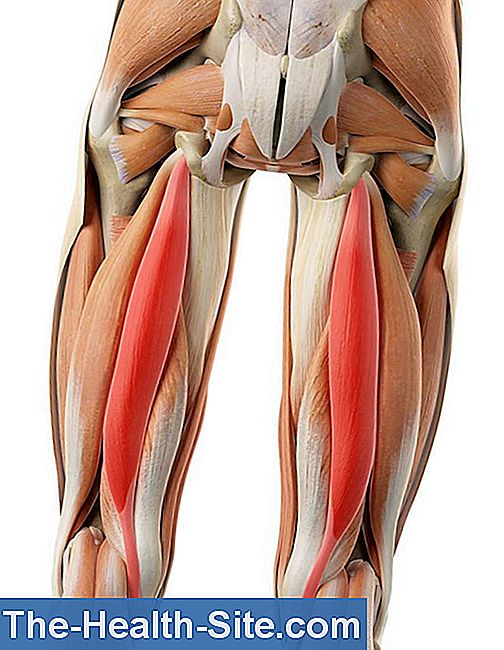 Întindere musculară: cauze, simptome și remedii - labrad.ro Blog