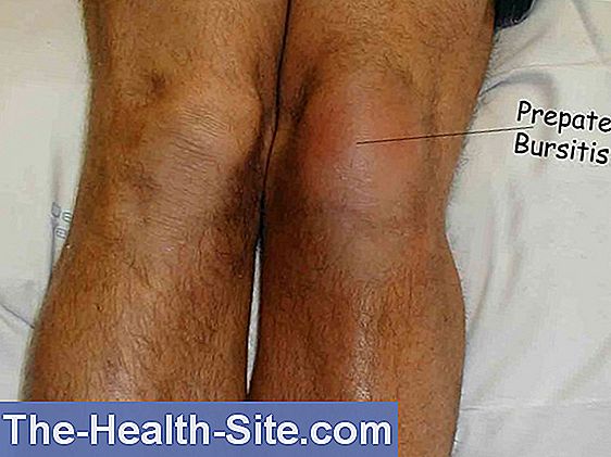 tratamente eficiente pentru genunchi durere reflectată în articulația umărului