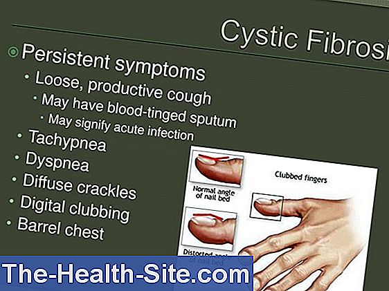 Cystisk fibrose - symptomer