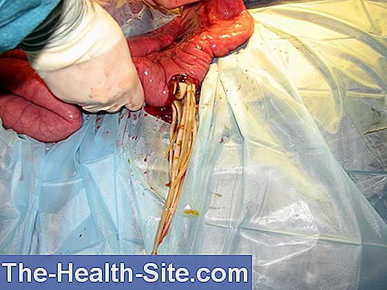 Klinieken - de 20 meest voorkomende operaties