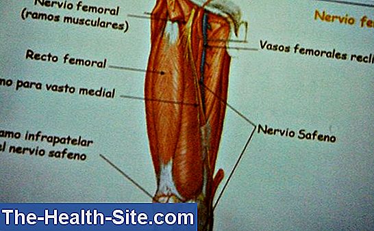 inflamația femurală este posibil să alergați cu artrita articulației genunchiului