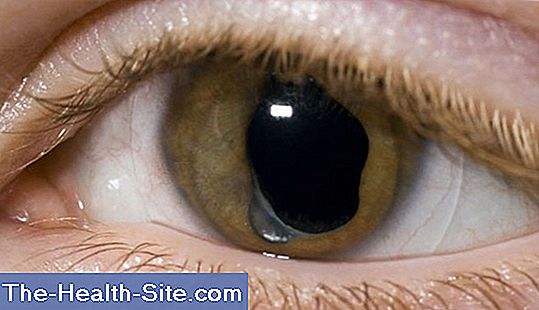 Cum să îmbunătățiți vederea ochiului
