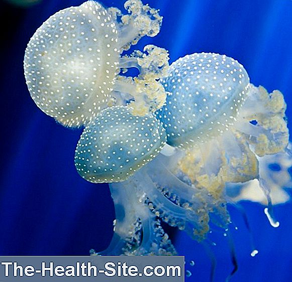 tratament comun cu meduze