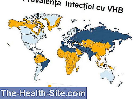 Hepatita A Infecție Simptome Tratament științifico Practic