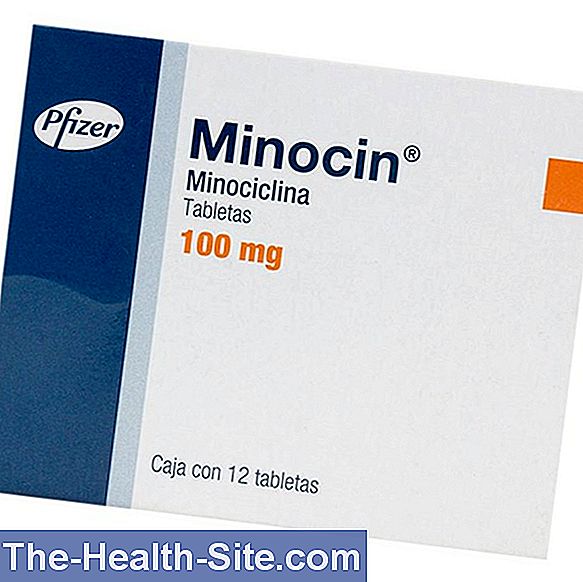 minociclina pentru tratamentul articular