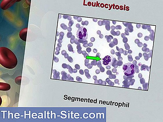 Leukocytos