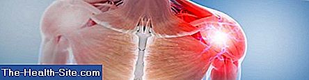 Tendonitis ๐ Scientific Biology Diagrams